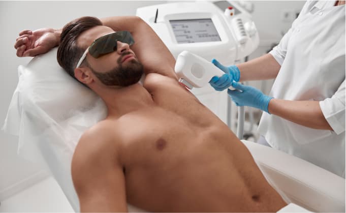 laser hair removal in Coral Gables