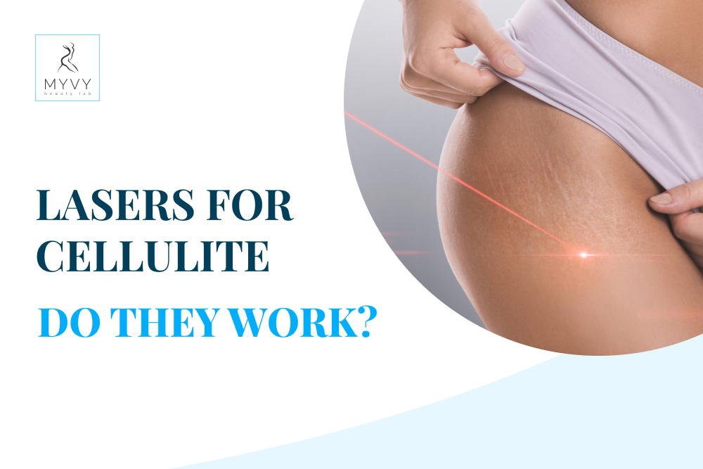 Lasers for cellulite